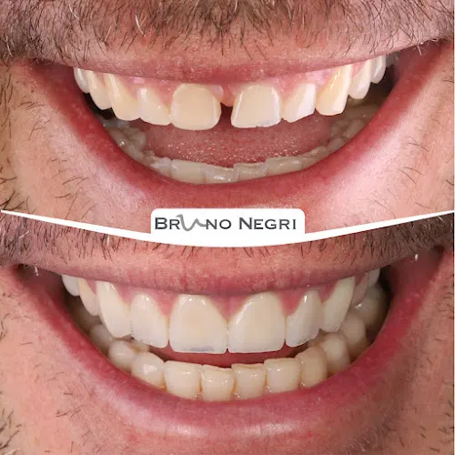 Clínica Dental Integral Dr. Bruno Negri