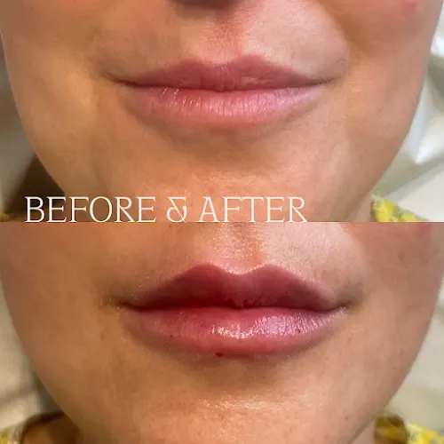 Clínica de Medicina Estética y Bienestar en Longevity by Dra.Eva Garrigós - Alicante