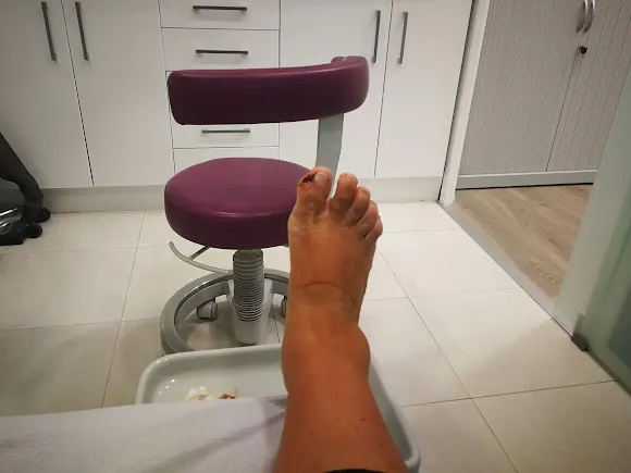 Clínica del Pie Alicante, Podología, Cirugía, Fisioterapia y Osteopatía