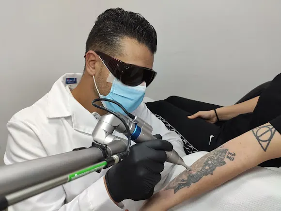 Ink Laser "Eliminar tatuajes Alicante" - Alicante