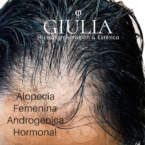 Giulia -Clínica Estética Especialista en Micropigmentación - Alicante