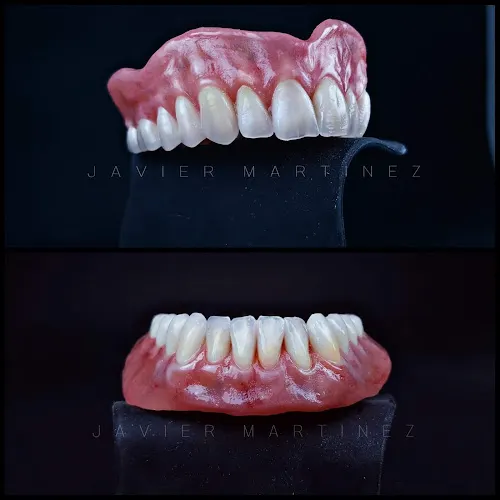 Laboratorio Dental JM - San Vicente del Raspeig