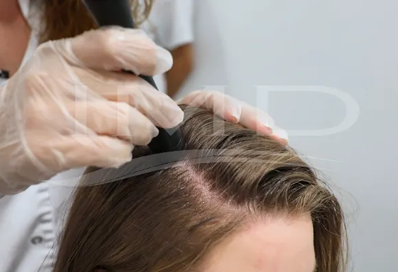 Clínica capilar IMD - Instituto Médico Dermatológico - Alicante