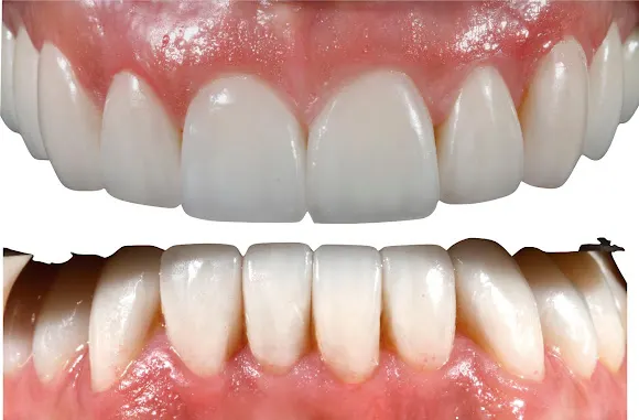 Cirugía Facial Benidorm by Dr. Batllés - Benidorm