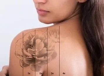 Renata Gama beauty Kiara - Torrevieja