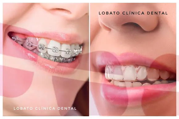 Lobato Clínica Dental | Dentista en Elche - Elche