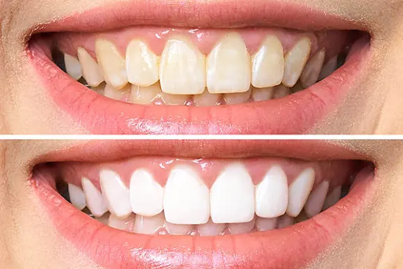 Clinica Dental Novadent - Aspe