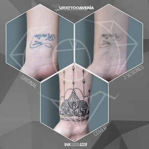 Eliminación de Tatuajes Alicante - QUITATTOOAVERIA - Alicante