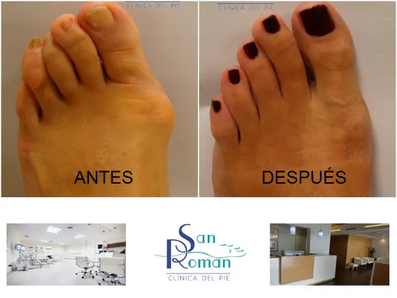 Clínica Podológica San Román en Alicante - Alicante