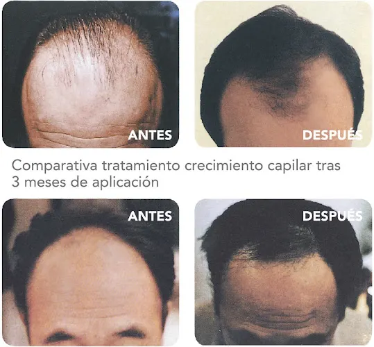 Aitana Estética y Bienestar - Torrevieja