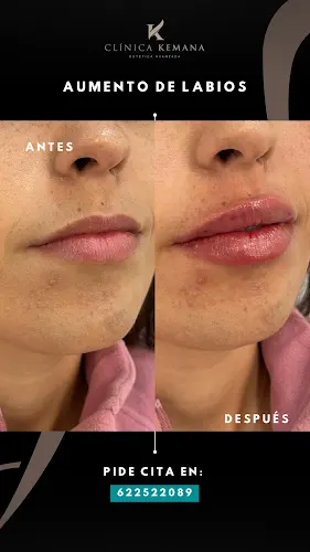 Clínica de Estética Kemana