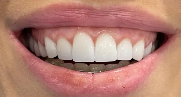 Clínica Dental Mosqueira - Alicante